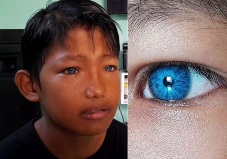 Arjuna Bocah 9 Tahun Asal Tarakan Miliki Mata Berwarna Biru, Tak Ada Keturunan Bule